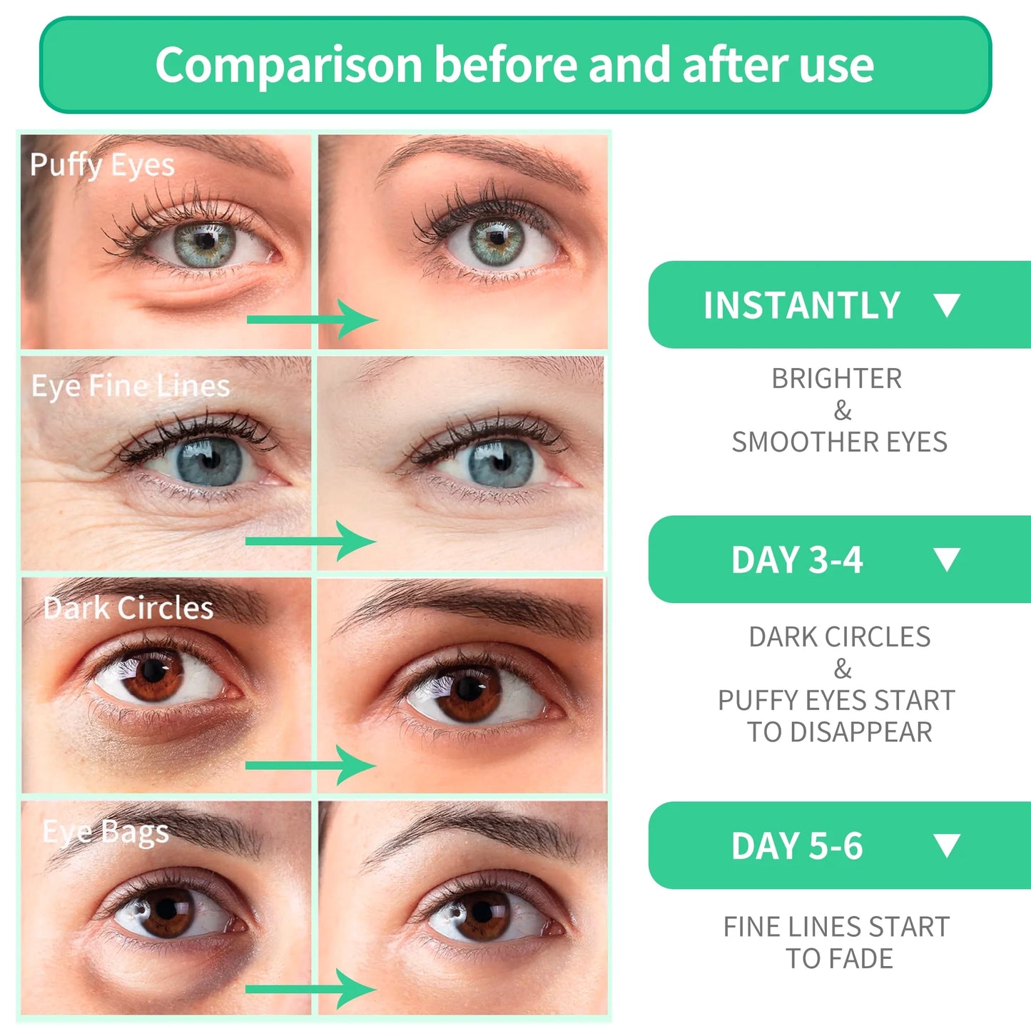 Natural Aloe Vera Eye Mask, 30 Pairs, Anti-Wrinkle Face Care for Dark Circles and Puffiness