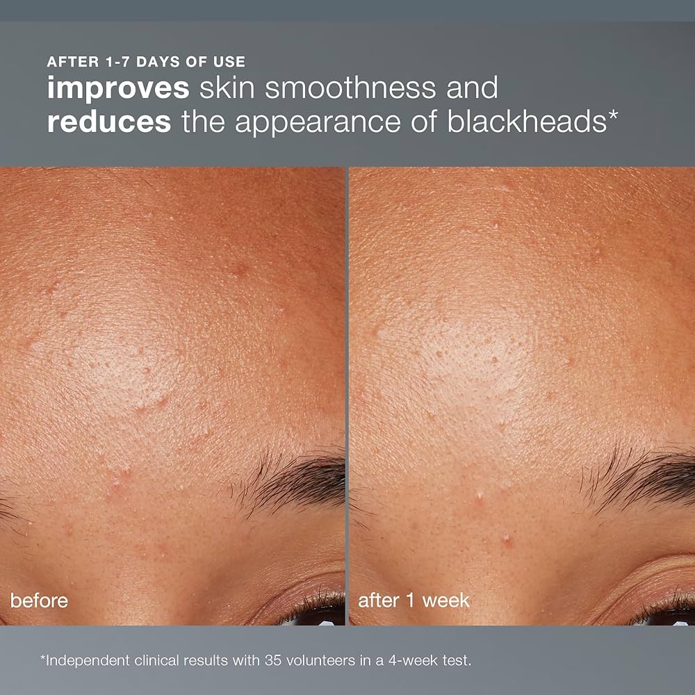 Daily Microfoliant Powder (Smooth & Brighten)