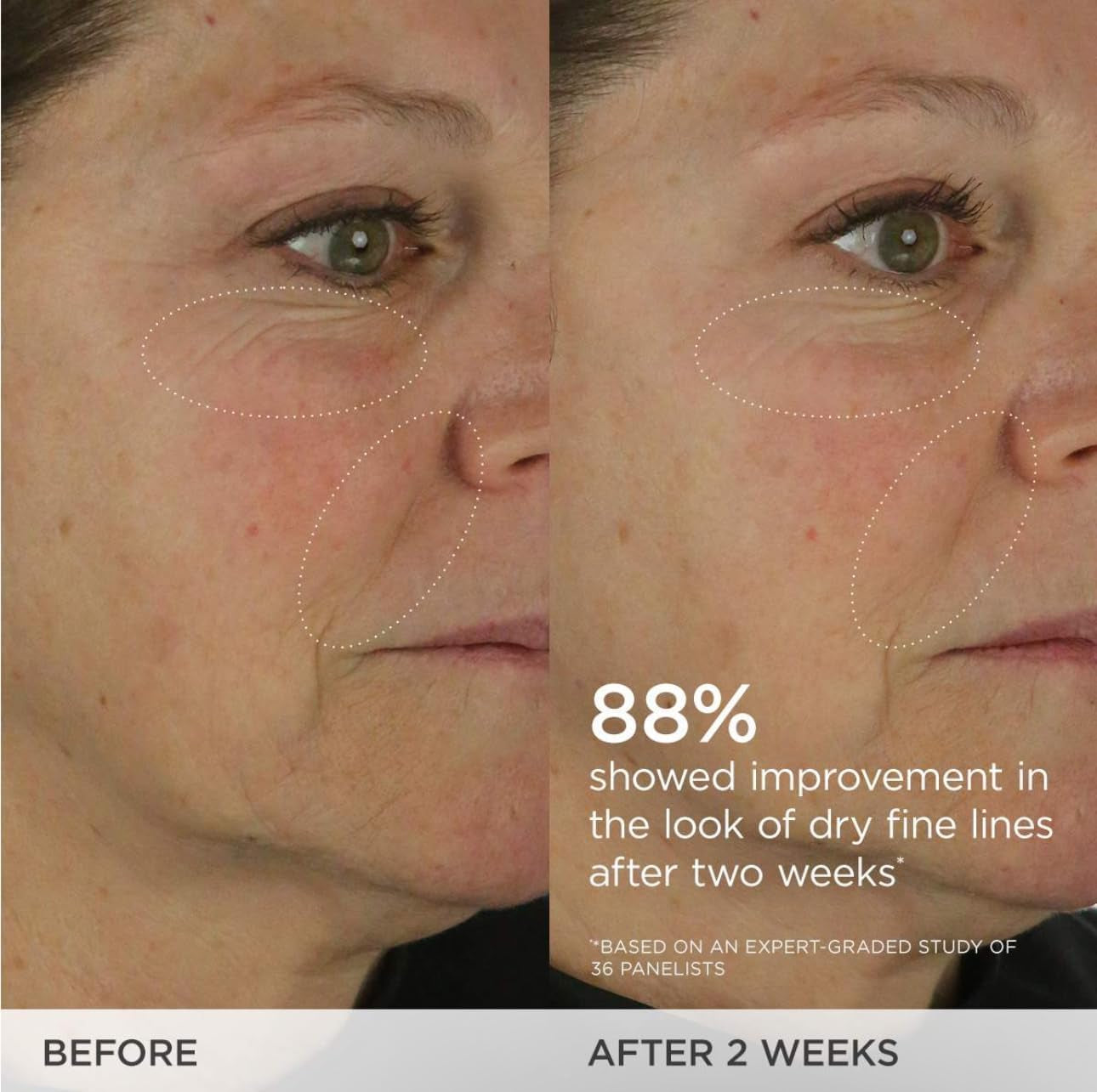 the Dewy Skin Cream | Rich Face Cream to Hydrate, Plump and Protect Dry and Combo Skin,